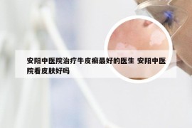 安阳中医院治疗牛皮癣最好的医生 安阳中医院看皮肤好吗