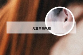 儿童白癜风脸