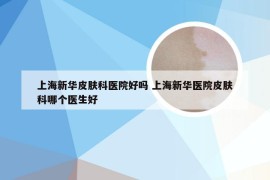 上海新华皮肤科医院好吗 上海新华医院皮肤科哪个医生好