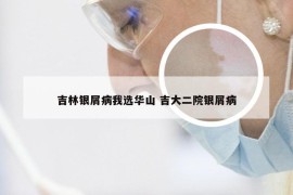 吉林银屑病我选华山 吉大二院银屑病