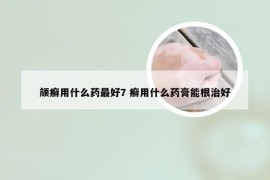 颃癣用什么药最好7 癣用什么药膏能根治好