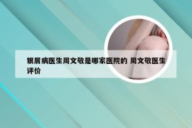 银屑病医生周文敬是哪家医院的 周文敬医生评价