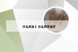 什么药治廯 什么药可治疗