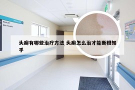 头癣有哪些治疗方法 头癣怎么治才能断根知乎