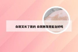 白斑又长了新的 白斑刚发现能治好吗