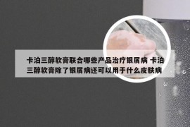 卡泊三醇软膏联合哪些产品治疗银屑病 卡泊三醇软膏除了银屑病还可以用于什么皮肤病