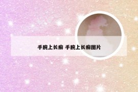 手腕上长癣 手腕上长癣图片