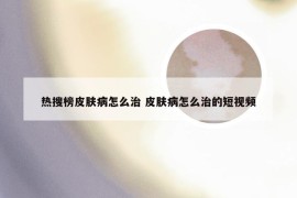 热搜榜皮肤病怎么治 皮肤病怎么治的短视频