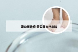 雷公藤治癣 雷公藤治疗皮肤