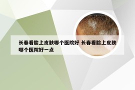 长春看脸上皮肤哪个医院好 长春看脸上皮肤哪个医院好一点