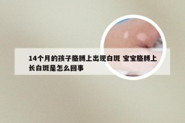 14个月的孩子胳膊上出现白斑 宝宝胳膊上长白斑是怎么回事