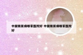 中国银屑病哪家医院好 中国银屑病哪家医院好
