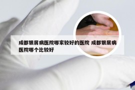 成都银屑病医院哪家较好的医院 成都银屑病医院哪个比较好