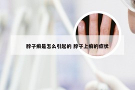 脖子癣是怎么引起的 脖子上癣的症状