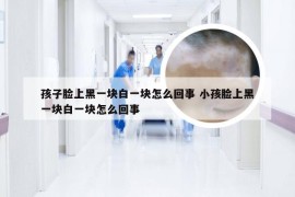 孩子脸上黑一块白一块怎么回事 小孩脸上黑一块白一块怎么回事
