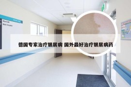 德国专家治疗银屑病 国外最好治疗银屑病药