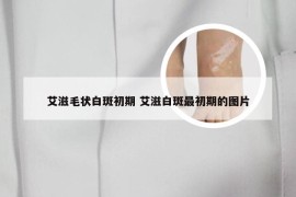 艾滋毛状白斑初期 艾滋白斑最初期的图片