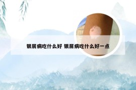 银屑病吃什么好 银屑病吃什么好一点