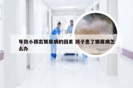 导致小孩出银屑病的因素 孩子患了银屑病怎么办