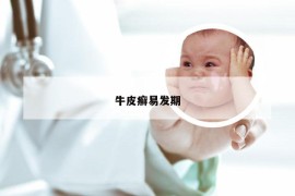 牛皮癣易发期