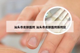 汕头市皮肤医院 汕头市皮肤医院新院区