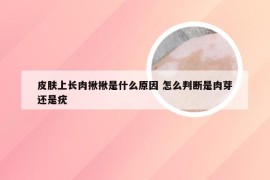 皮肤上长肉揪揪是什么原因 怎么判断是肉芽还是疣