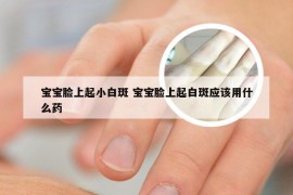 宝宝脸上起小白斑 宝宝脸上起白斑应该用什么药