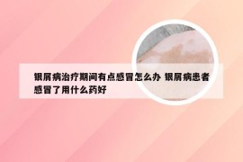 银屑病治疗期间有点感冒怎么办 银屑病患者感冒了用什么药好