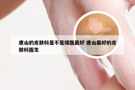 唐山的皮肤科是不是煤医最好 唐山最好的皮肤科医生