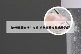 沧州哪里治疗牛皮癣 沧州哪看皮肤病看的好