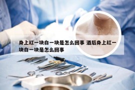 身上红一块白一块是怎么回事 酒后身上红一块白一块是怎么回事