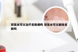 双氧水可以治疗皮肤病吗 双氧水可以解除皮肤吗