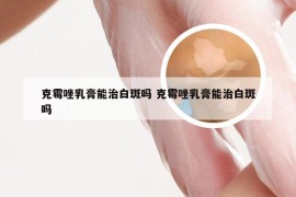 克霉唑乳膏能治白斑吗 克霉唑乳膏能治白斑吗