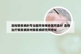 洛阳银屑病的专治医院有哪些医院最好 洛阳治疗银屑病郑州银屑病研究院地址