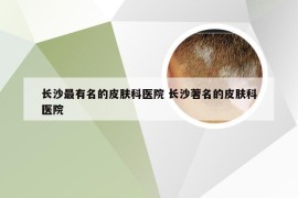 长沙最有名的皮肤科医院 长沙著名的皮肤科医院
