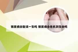 银屑病会耽误一生吗 银屑病会危机到生命吗
