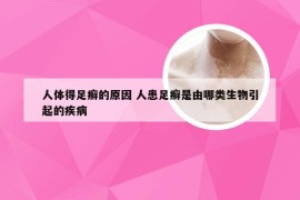 人体得足癣的原因 人患足癣是由哪类生物引起的疾病