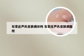 石家庄芦氏皮肤病诊所 石家庄芦氏皮肤病医院