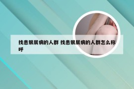 找患银屑病的人群 找患银屑病的人群怎么称呼
