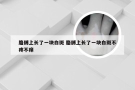 胳膊上长了一块白斑 胳膊上长了一块白斑不疼不痒