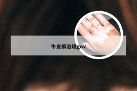 牛皮癣治理gov
