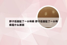 脖子后面起了一小块癣 脖子后面起了一小块癣是什么原因