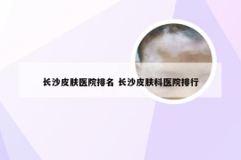 长沙皮肤医院排名 长沙皮肤科医院排行
