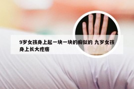 9岁女孩身上起一块一块的癣似的 九岁女孩身上长大疙瘩
