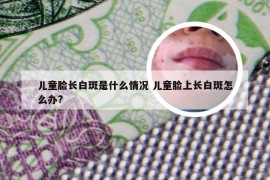 儿童脸长白斑是什么情况 儿童脸上长白斑怎么办?