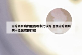 治疗银屑病的医院哪家比较好 全国治疗银屑病十佳医院排行榜