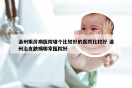 温州银屑病医院哪个比较好的医院比较好 温州治皮肤病哪家医院好