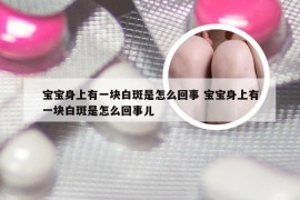 宝宝身上有一块白斑是怎么回事 宝宝身上有一块白斑是怎么回事儿