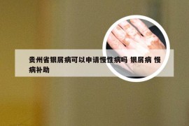 贵州省银屑病可以申请慢性病吗 银屑病 慢病补助