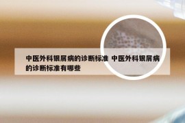 中医外科银屑病的诊断标准 中医外科银屑病的诊断标准有哪些